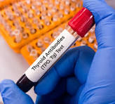 Thyroid Package Profile